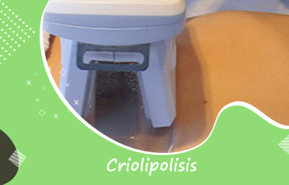 Criolipolisis
